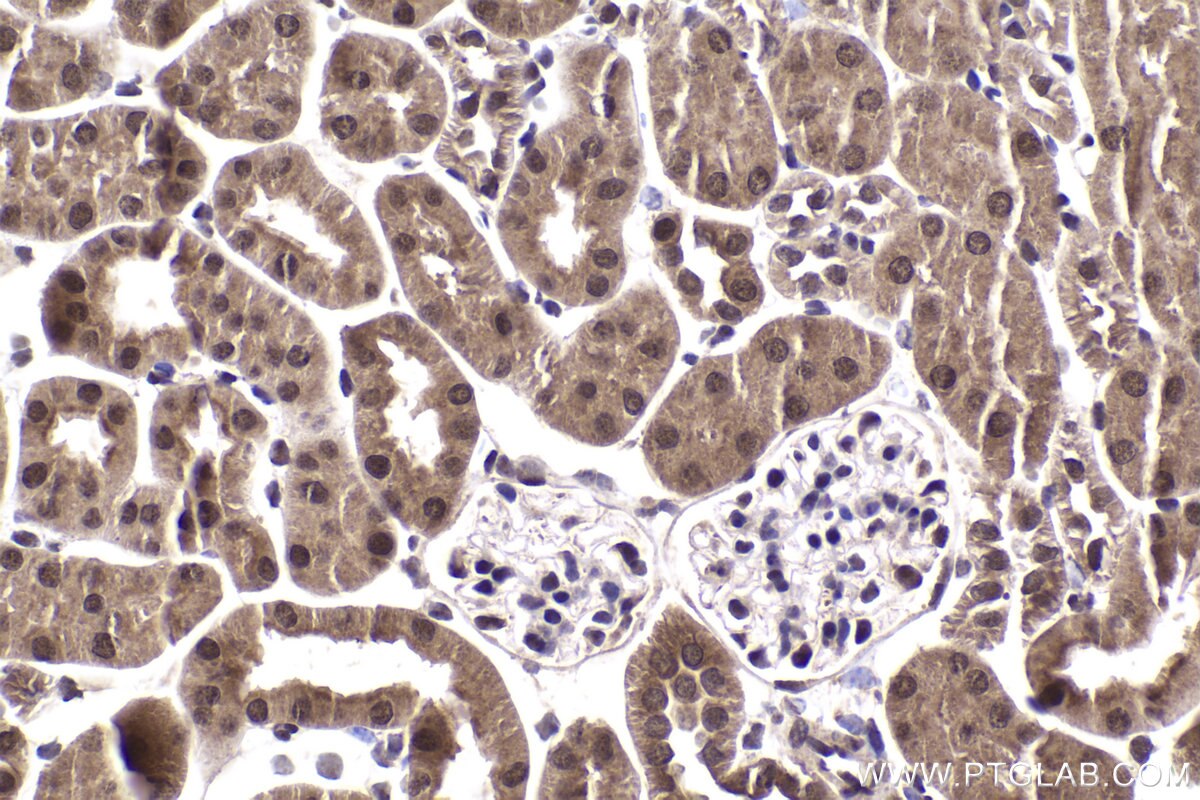 Immunohistochemical analysis of paraffin-embedded mouse kidney tissue slide using KHC2002 (SOX13 IHC Kit).