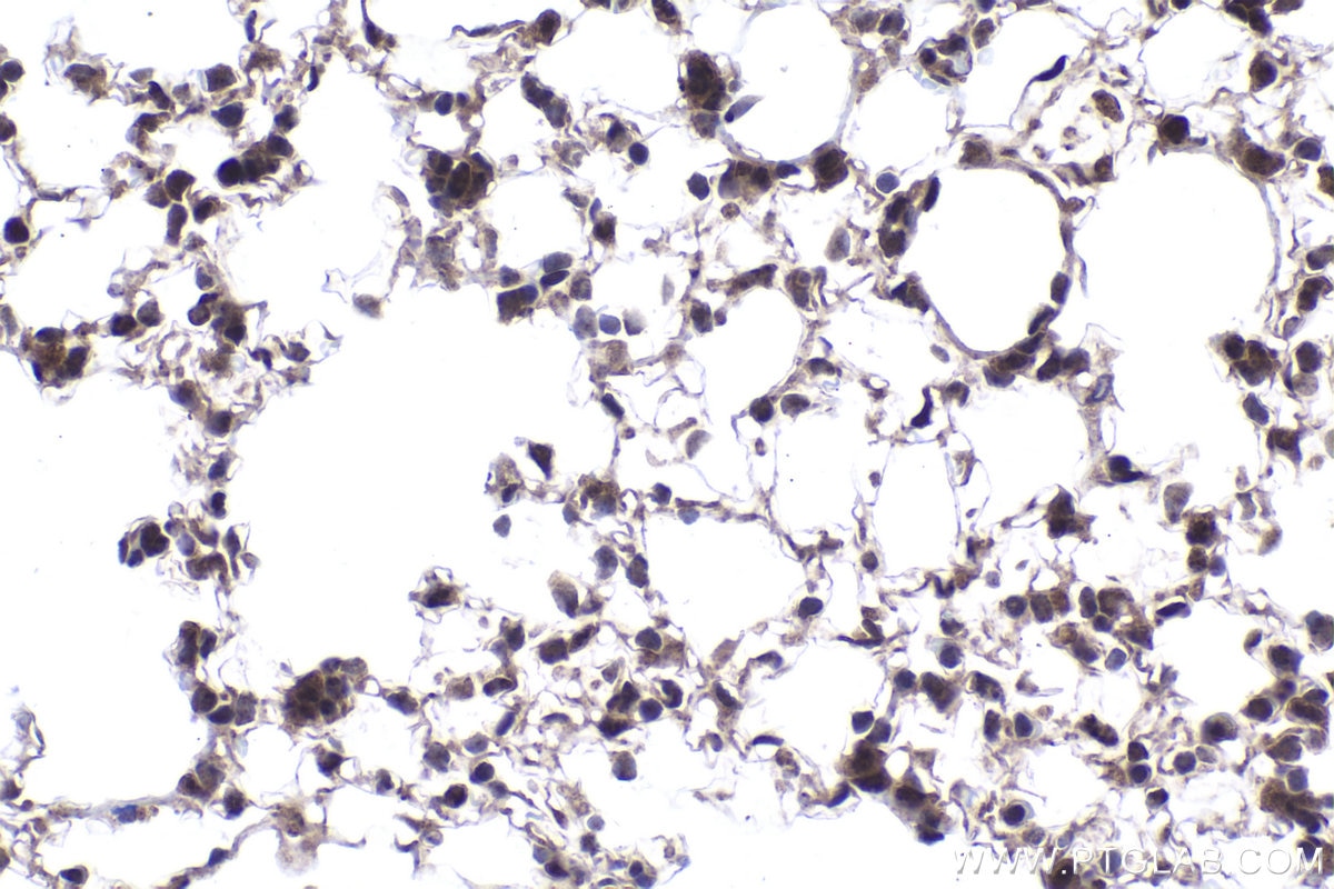Immunohistochemical analysis of paraffin-embedded mouse lung tissue slide using KHC2002 (SOX13 IHC Kit).