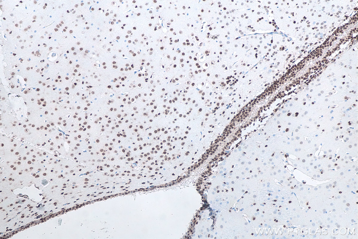 Immunohistochemical analysis of paraffin-embedded rat brain tissue slide using KHC0294 (SOX2 IHC Kit).