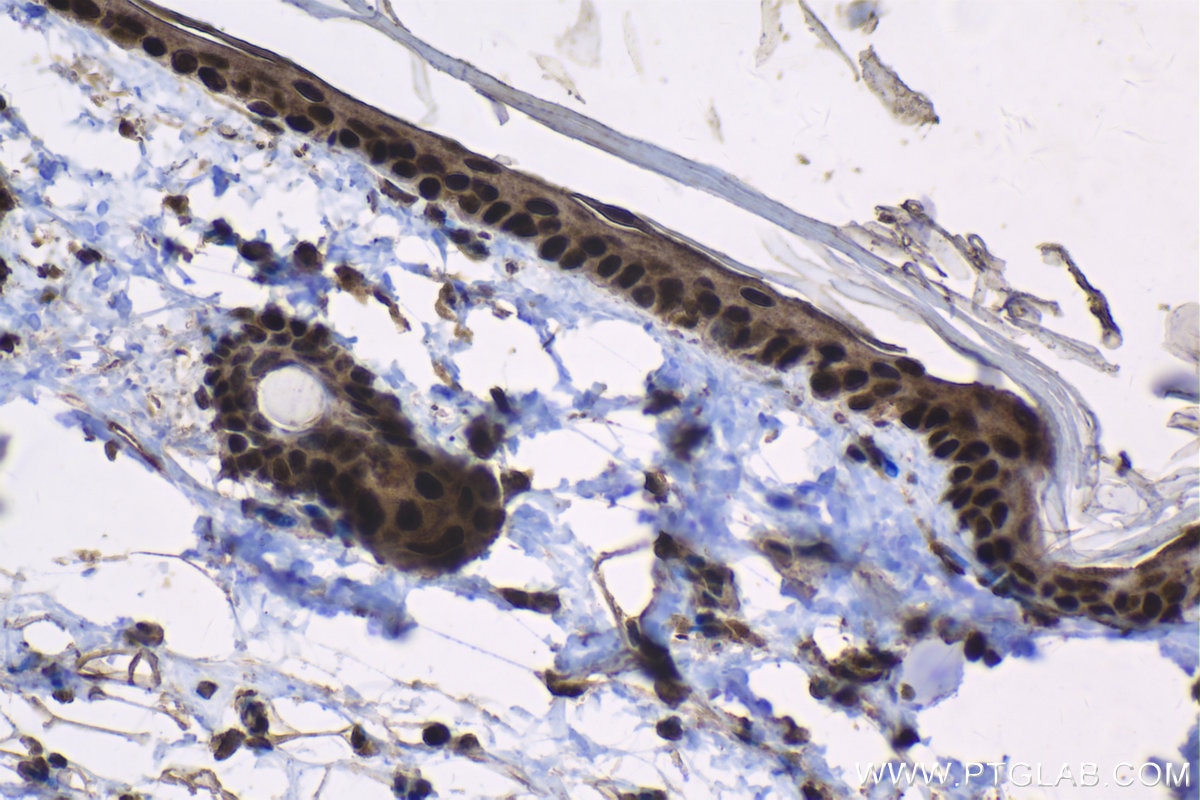 Immunohistochemical analysis of paraffin-embedded rat skin tissue slide using KHC1337 (SOX6 IHC Kit).