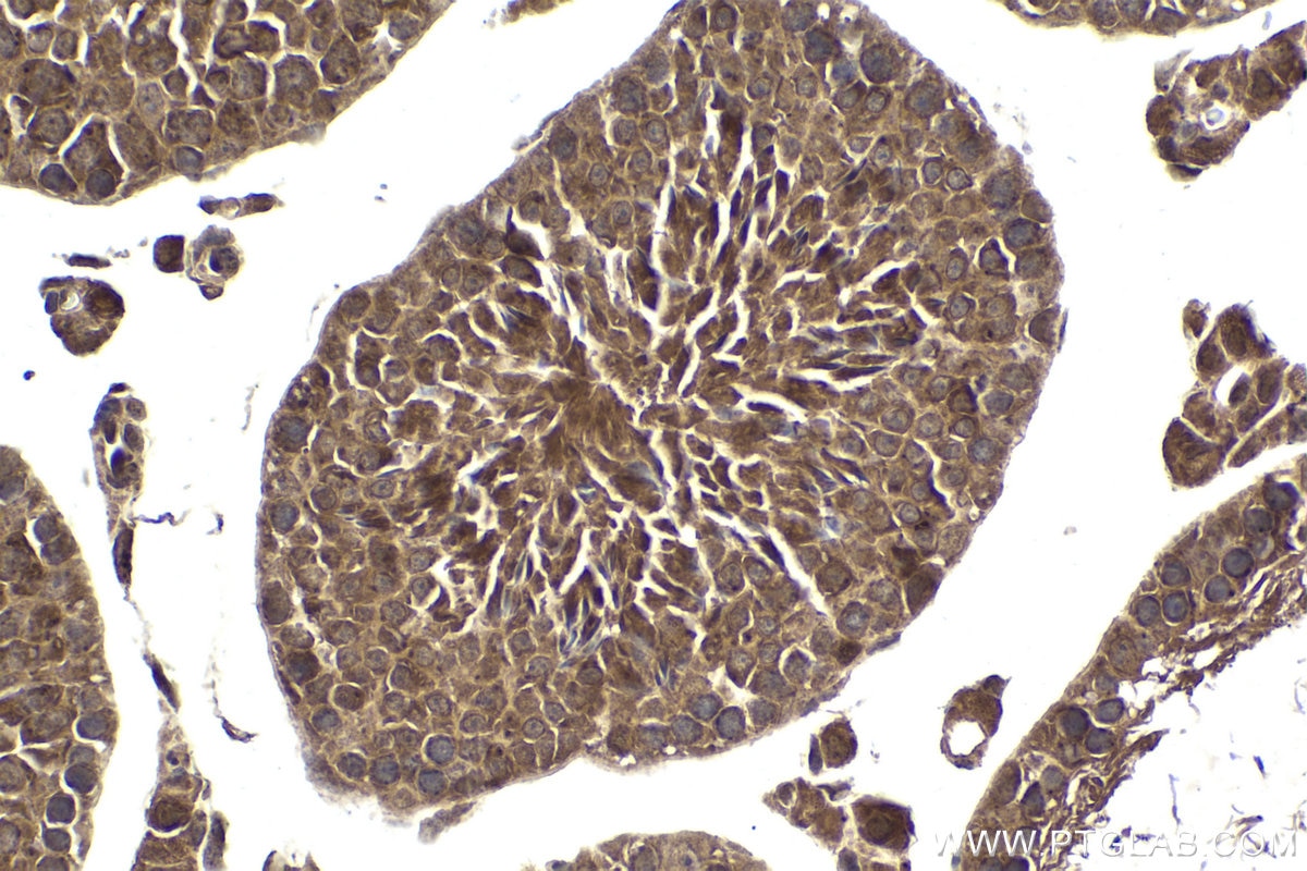 Immunohistochemical analysis of paraffin-embedded mouse testis tissue slide using KHC1903 (SOX7 IHC Kit).