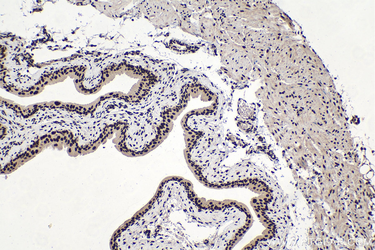 Immunohistochemical analysis of paraffin-embedded mouse bladder tissue slide using KHC1513 (SP1 IHC Kit).