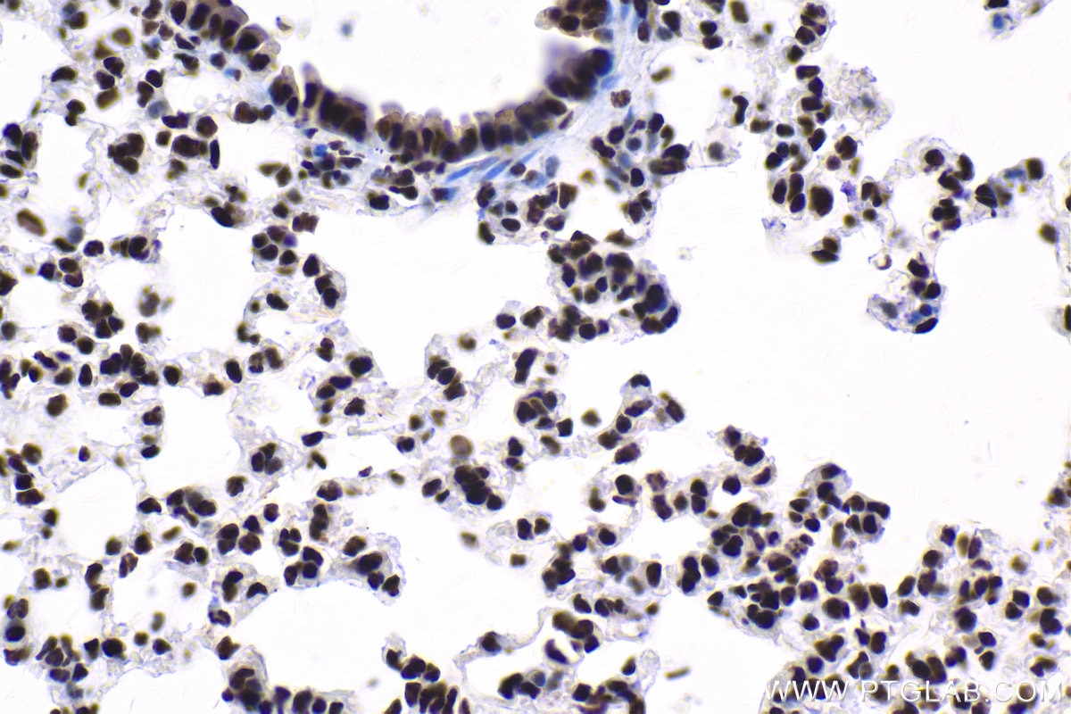 Immunohistochemical analysis of paraffin-embedded mouse lung tissue slide using KHC1669 (SP3 IHC Kit).