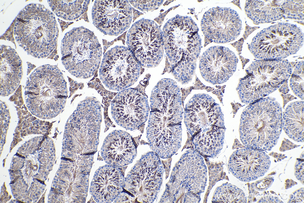 Immunohistochemical analysis of paraffin-embedded mouse testis tissue slide using KHC0123 (SPARC IHC Kit).