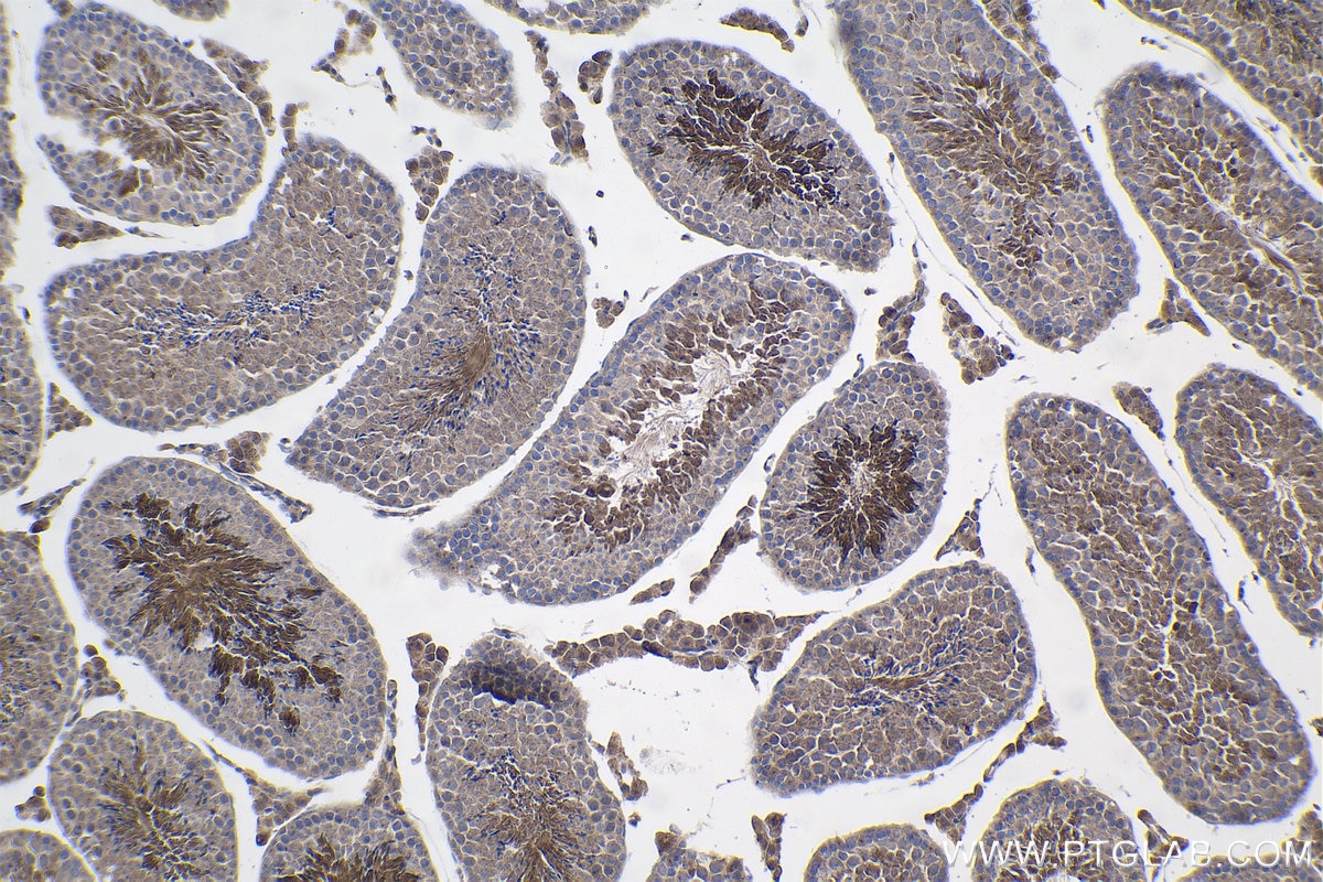 Immunohistochemical analysis of paraffin-embedded mouse testis tissue slide using KHC1089 (SPATA6 IHC Kit).