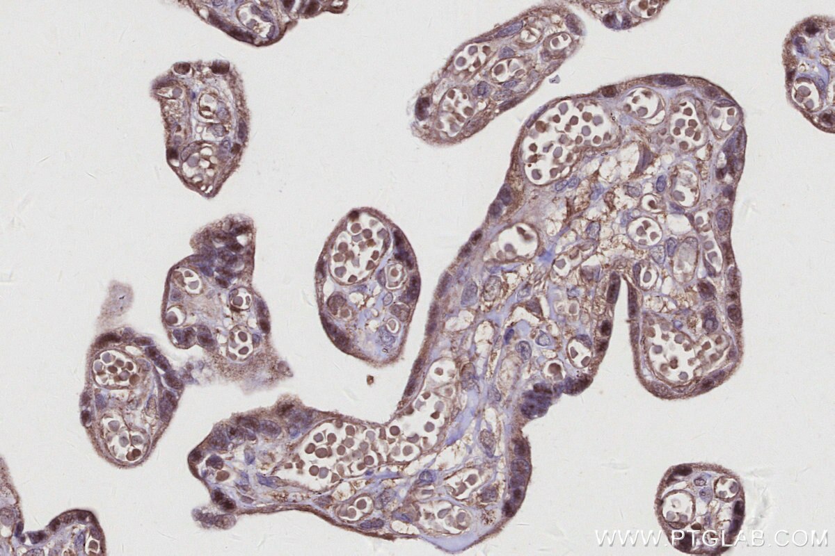 Immunohistochemical analysis of paraffin-embedded human placenta tissue slide using KHC2930 (SPC25 IHC Kit).
