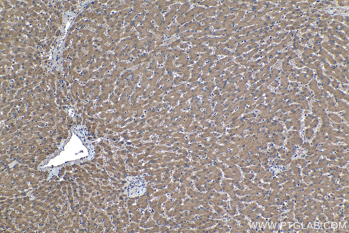 Immunohistochemical analysis of paraffin-embedded human liver tissue slide using KHC1181 (SPDYC IHC Kit).