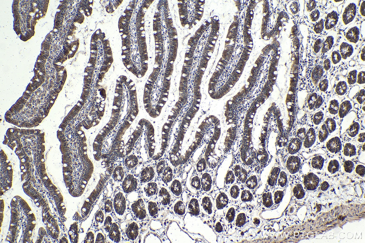 Immunohistochemical analysis of paraffin-embedded rat small intestine tissue slide using KHC1961 (SPHK2 IHC Kit).
