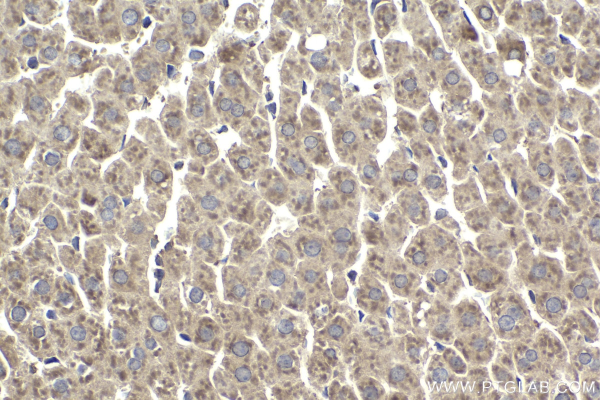 Immunohistochemical analysis of paraffin-embedded rat liver tissue slide using KHC1961 (SPHK2 IHC Kit).