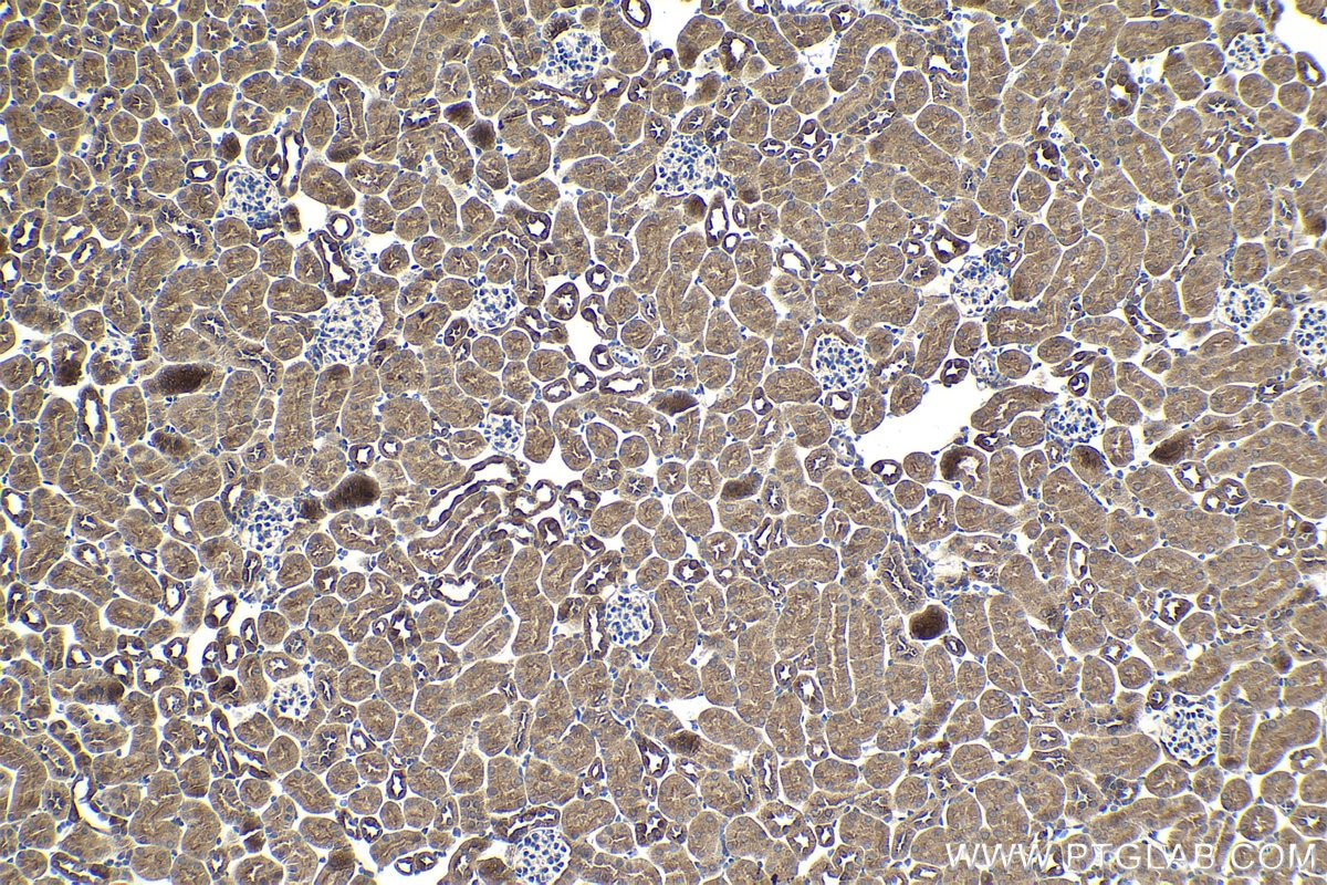 Immunohistochemical analysis of paraffin-embedded mouse kidney tissue slide using KHC1961 (SPHK2 IHC Kit).