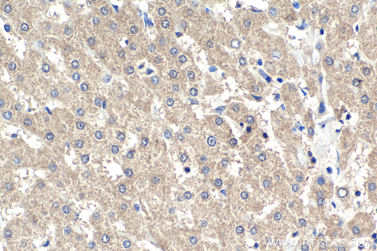 Immunohistochemical analysis of paraffin-embedded human liver tissue slide using KHC1961 (SPHK2 IHC Kit).