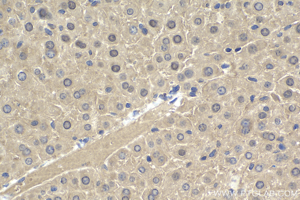 Immunohistochemical analysis of paraffin-embedded mouse liver tissue slide using KHC1961 (SPHK2 IHC Kit).