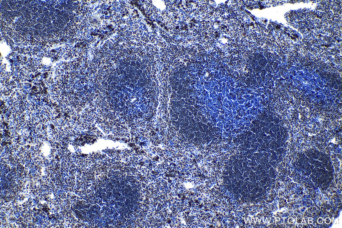 Immunohistochemical analysis of paraffin-embedded mouse spleen tissue slide using KHC1149 (SPI1 IHC Kit).