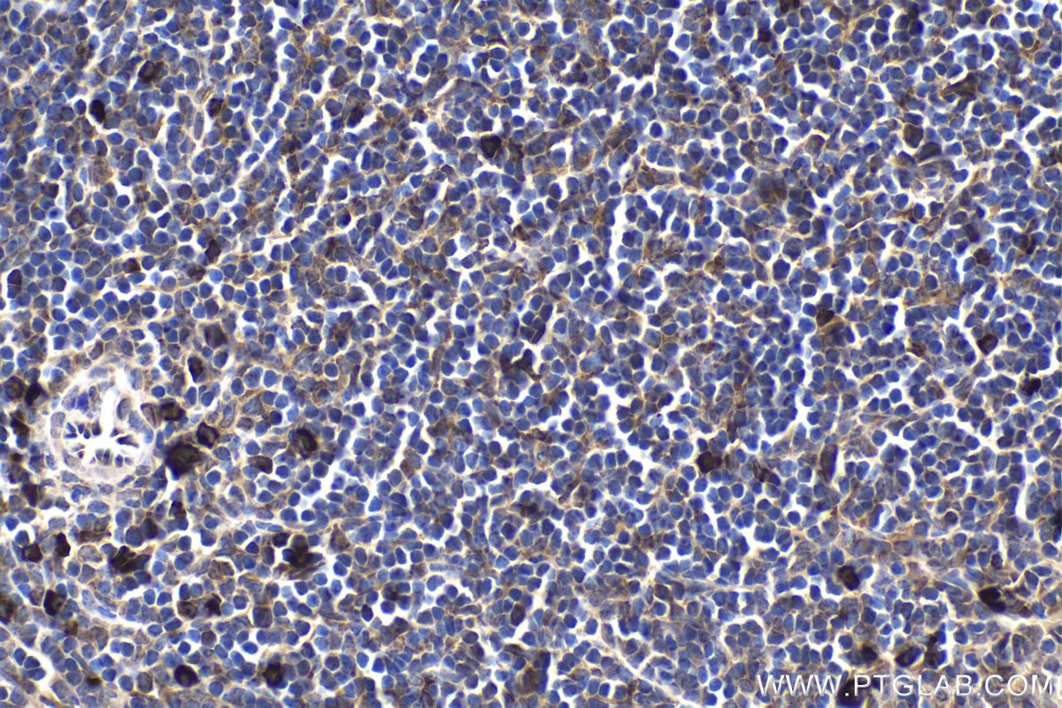 Immunohistochemical analysis of paraffin-embedded mouse spleen tissue slide using KHC1668 (SPIB IHC Kit).
