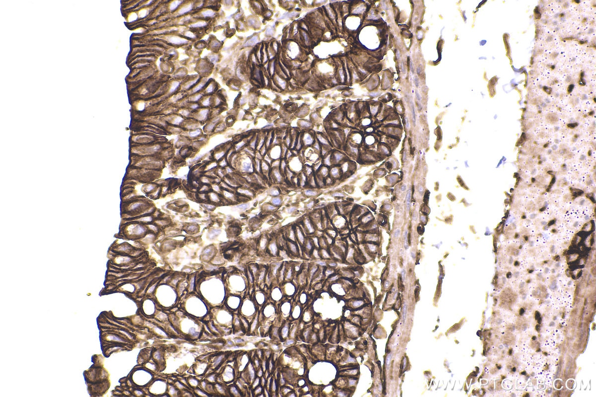 Immunohistochemical analysis of paraffin-embedded rat colon tissue slide using KHC2442 (SPTAN1 IHC Kit).