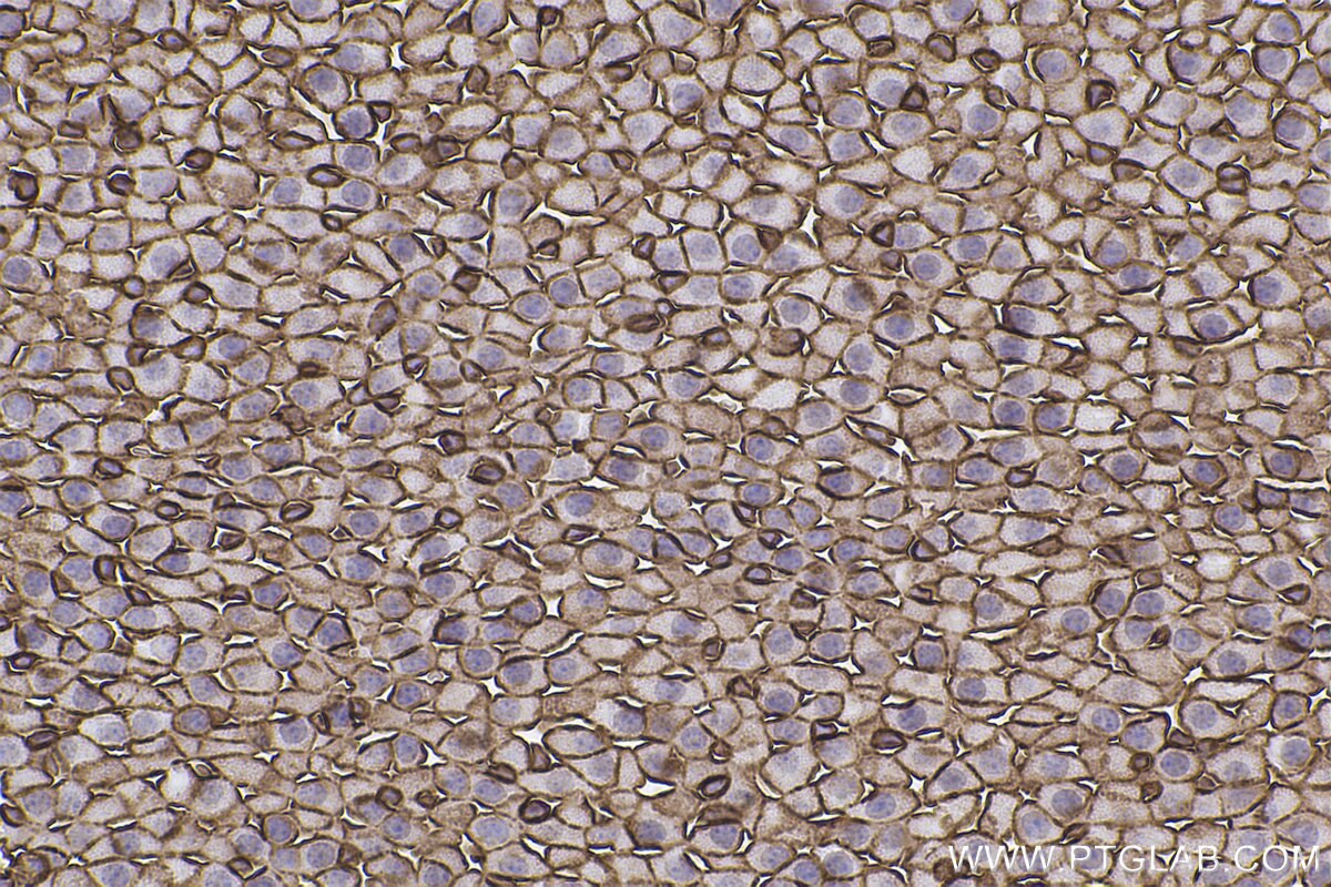 Immunohistochemical analysis of paraffin-embedded mouse adrenal gland tissue slide using KHC2442 (SPTAN1 IHC Kit).