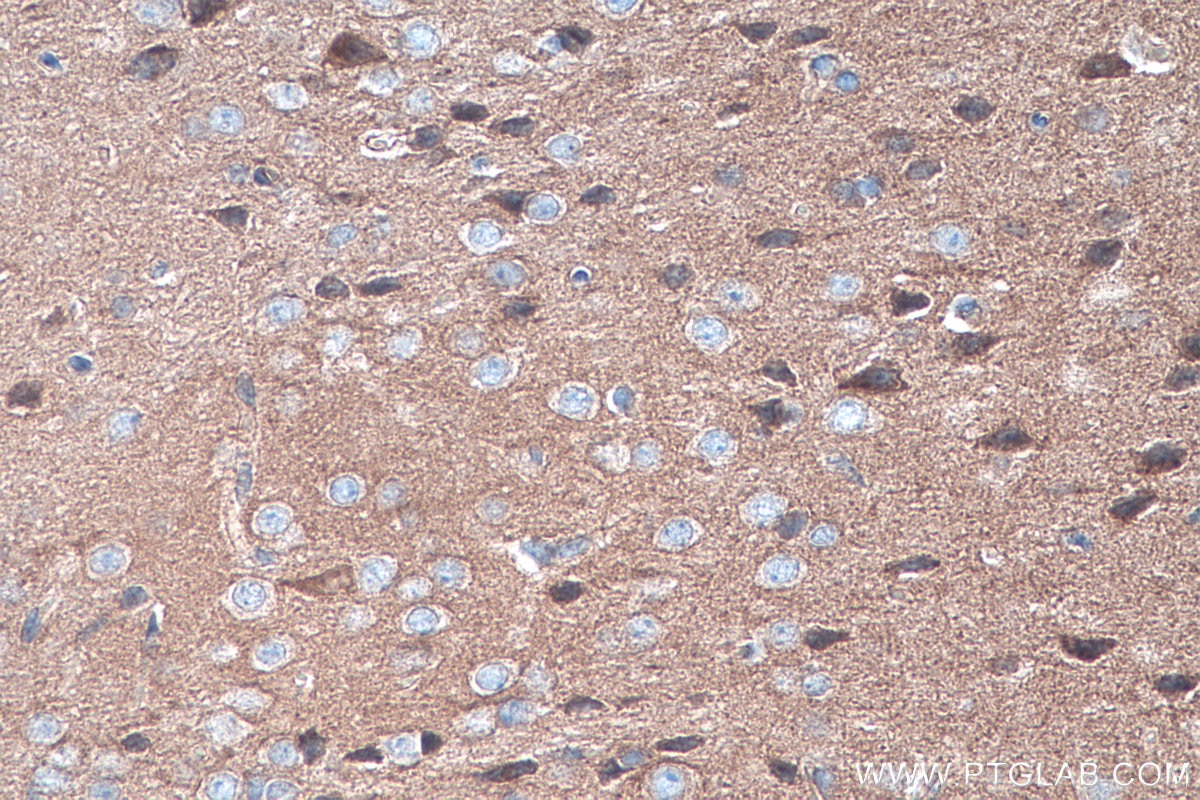 Immunohistochemical analysis of paraffin-embedded mouse brain tissue slide using KHC0301 (SPTB IHC Kit).