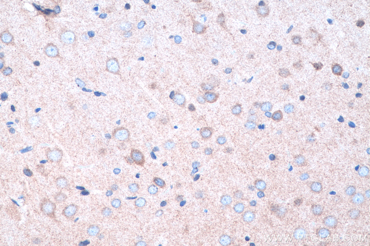 Immunohistochemical analysis of paraffin-embedded rat brain tissue slide using KHC0301 (SPTB IHC Kit).