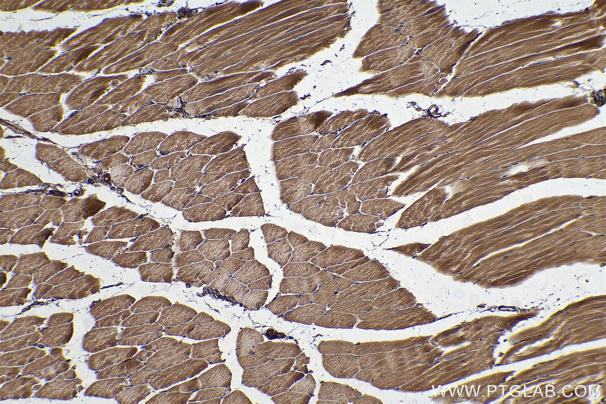 Immunohistochemical analysis of paraffin-embedded mouse skeletal muscle tissue slide using KHC0283 (SPTBN1 IHC Kit).