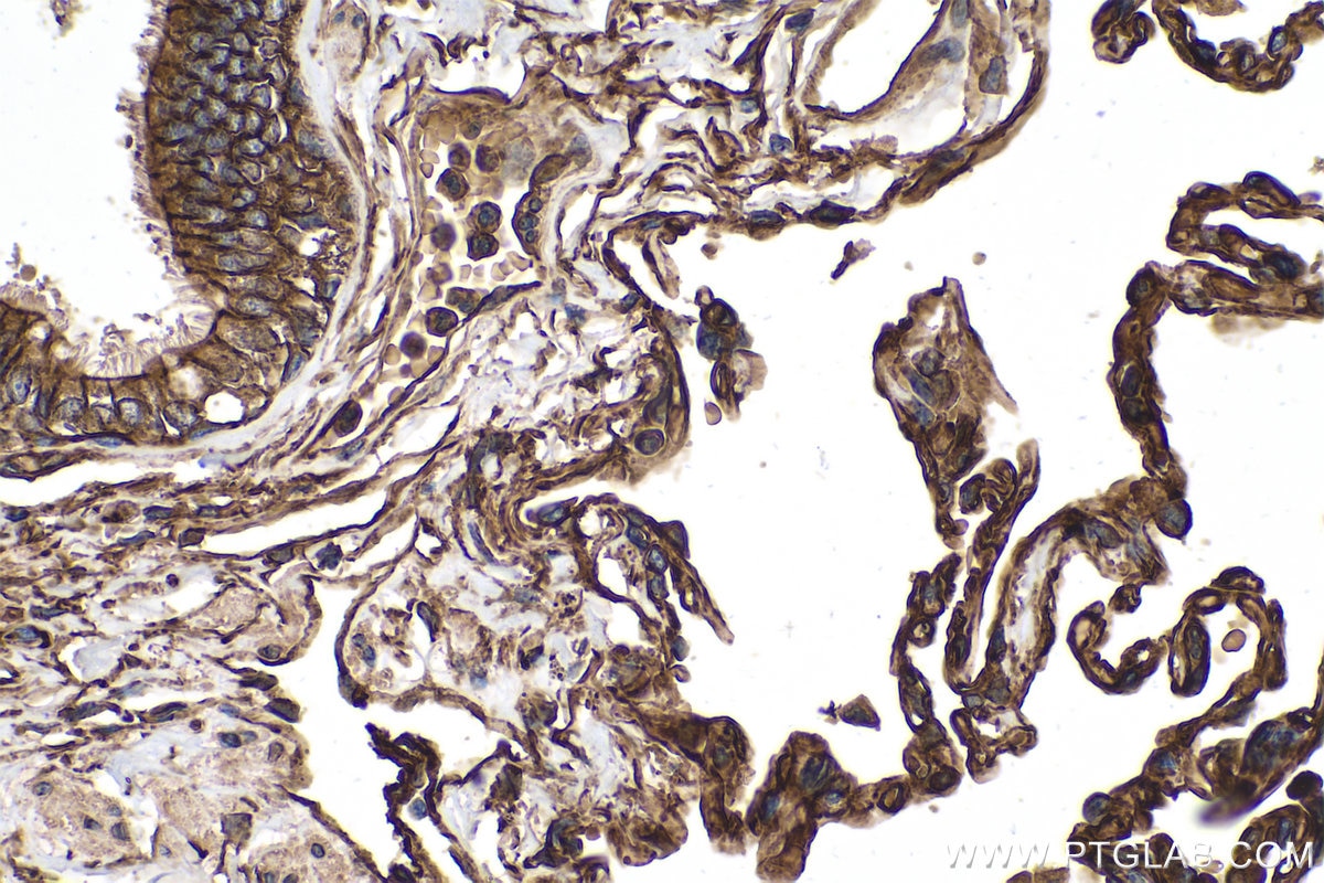 Immunohistochemical analysis of paraffin-embedded human lung tissue slide using KHC0283 (SPTBN1 IHC Kit).