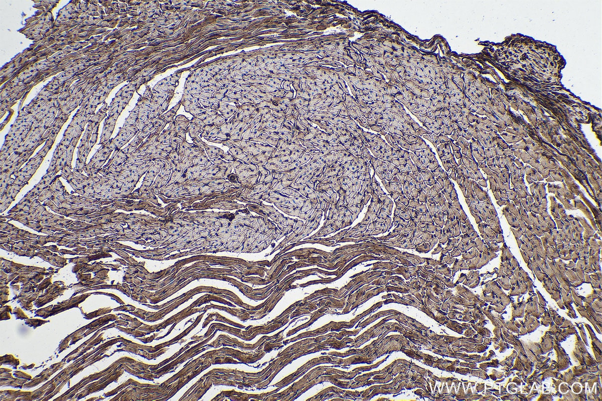 Immunohistochemical analysis of paraffin-embedded mouse heart tissue slide using KHC0283 (SPTBN1 IHC Kit).