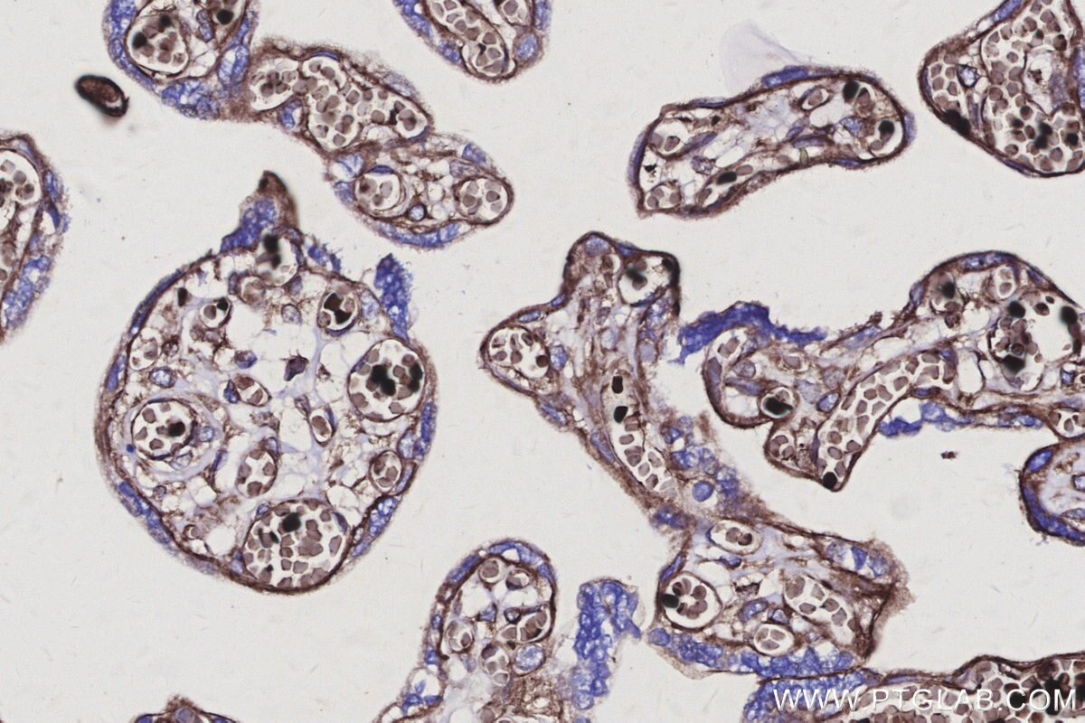 Immunohistochemical analysis of paraffin-embedded human placenta tissue slide using KHC3138 (SPTLC2 IHC Kit).