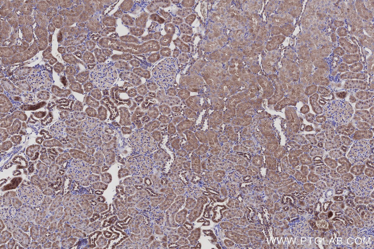 Immunohistochemical analysis of paraffin-embedded rat kidney tissue slide using KHC3138 (SPTLC2 IHC Kit).