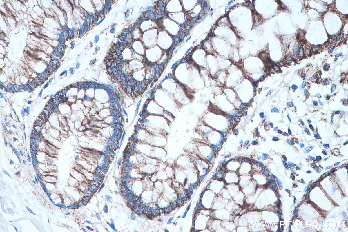 Immunohistochemical analysis of paraffin-embedded human colon tissue slide using KHC0466 (SQRDL IHC Kit).