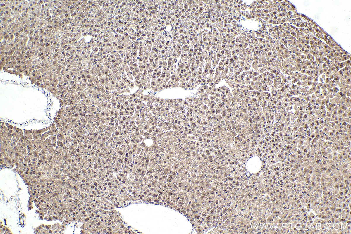 Immunohistochemical analysis of paraffin-embedded mouse liver tissue slide using KHC1587 (SREBF1 IHC Kit).