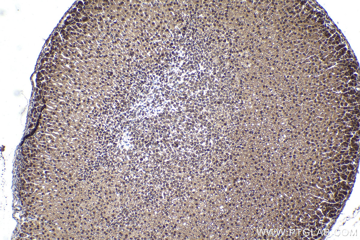 Immunohistochemical analysis of paraffin-embedded mouse adrenal gland tissue slide using KHC1587 (SREBF1 IHC Kit).