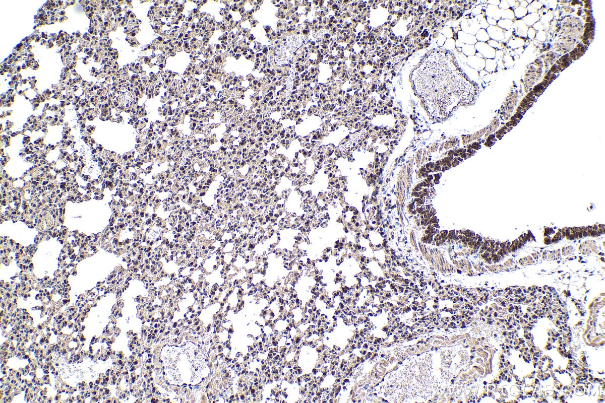 Immunohistochemical analysis of paraffin-embedded mouse lung tissue slide using KHC1587 (SREBF1 IHC Kit).