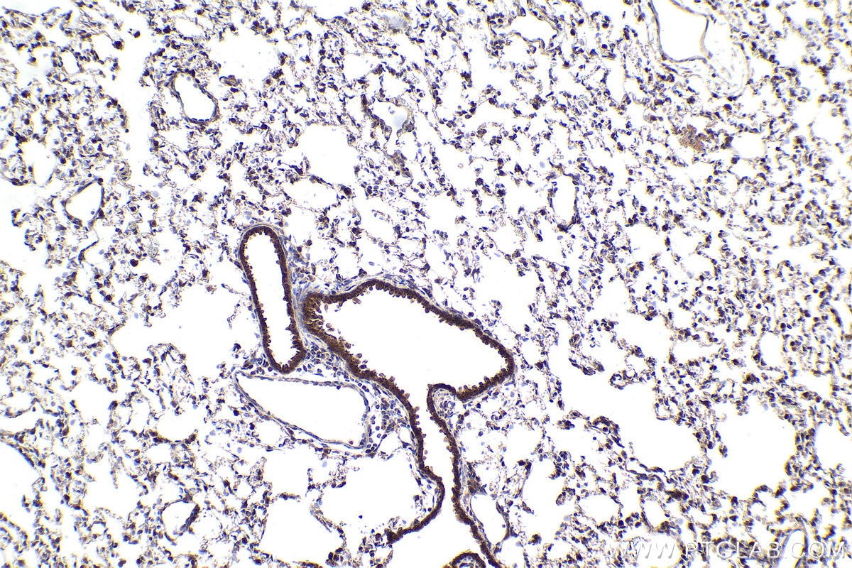 Immunohistochemical analysis of paraffin-embedded rat lung tissue slide using KHC1587 (SREBF1 IHC Kit).