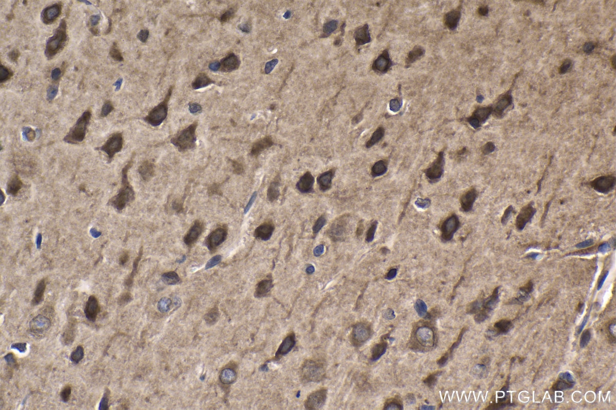 Immunohistochemical analysis of paraffin-embedded rat brain tissue slide using KHC1689 (SREBF2 IHC Kit).