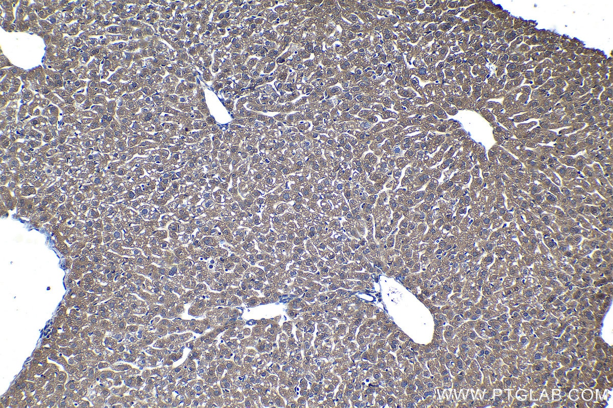 Immunohistochemical analysis of paraffin-embedded mouse liver tissue slide using KHC1283 (SRGAP1 IHC Kit).