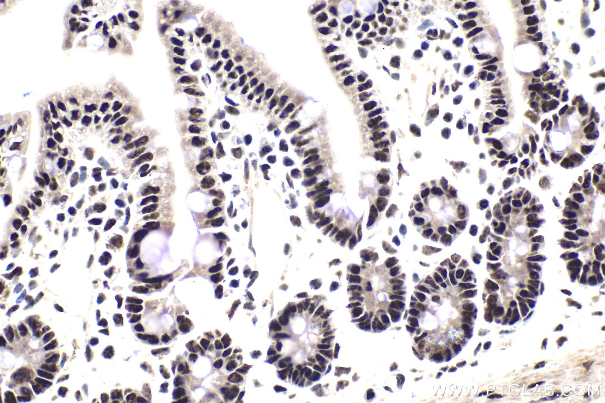 Immunohistochemical analysis of paraffin-embedded mouse small intestine tissue slide using KHC1824 (SRRM1 IHC Kit).