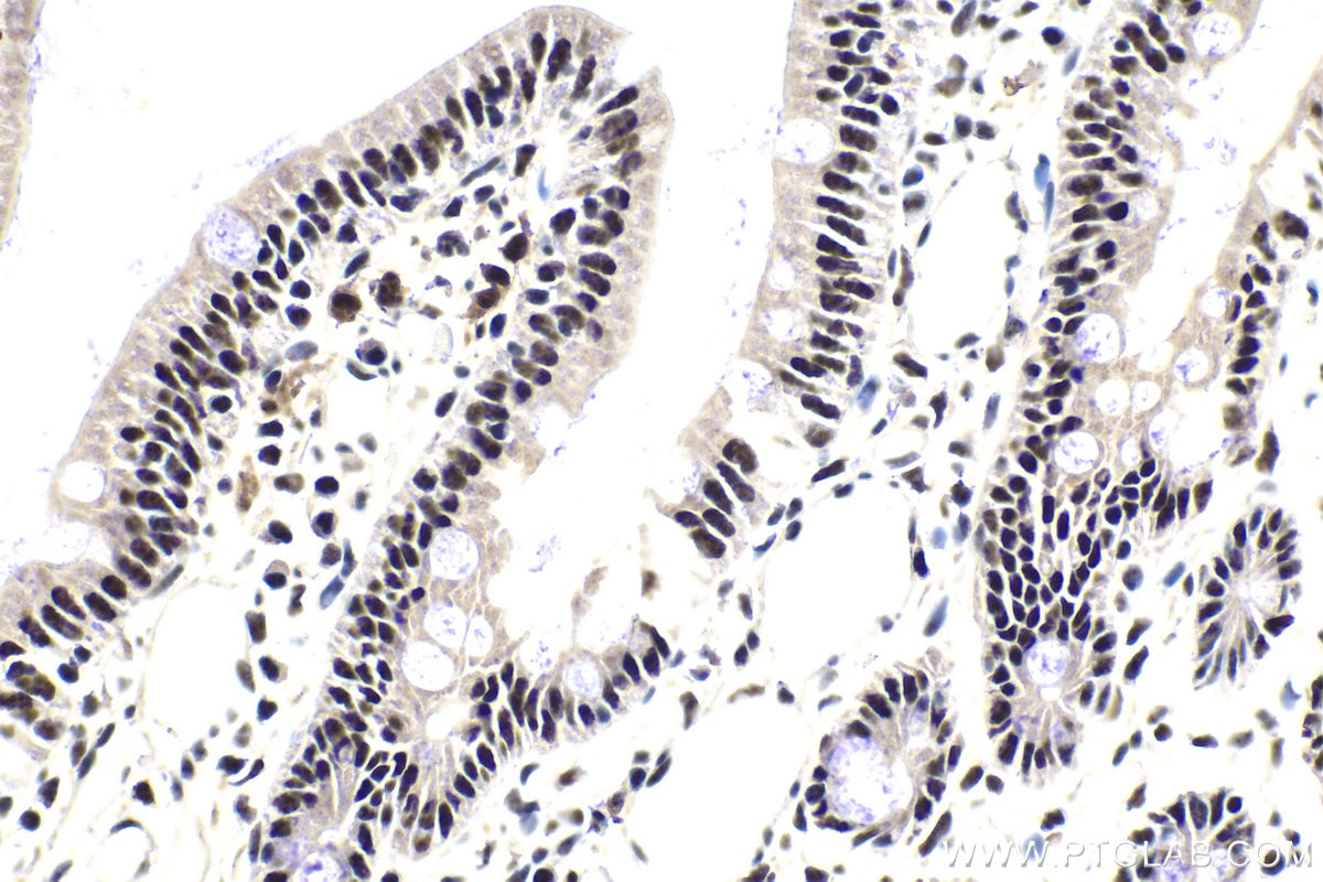Immunohistochemical analysis of paraffin-embedded rat small intestine tissue slide using KHC1824 (SRRM1 IHC Kit).