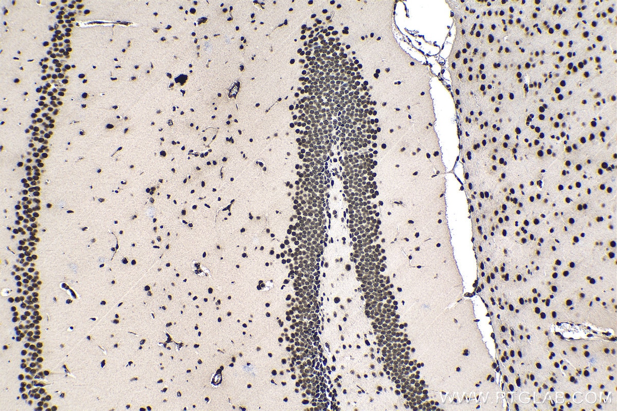 Immunohistochemical analysis of paraffin-embedded mouse brain tissue slide using KHC1396 (SRSF1 IHC Kit).