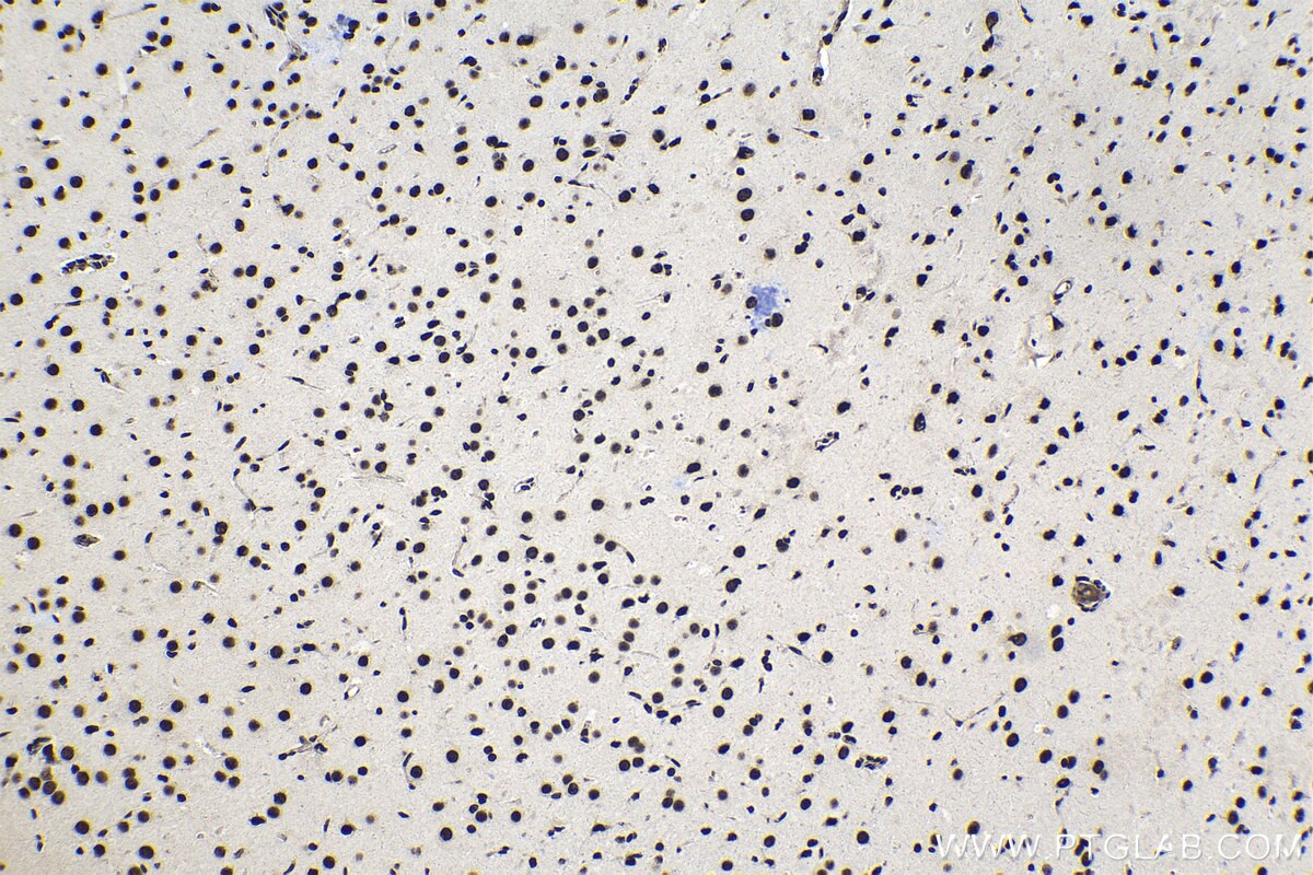 Immunohistochemical analysis of paraffin-embedded rat brain tissue slide using KHC1396 (SRSF1 IHC Kit).