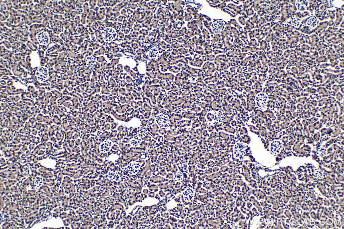 Immunohistochemical analysis of paraffin-embedded mouse kidney tissue slide using KHC1390 (SRSF11 IHC Kit).