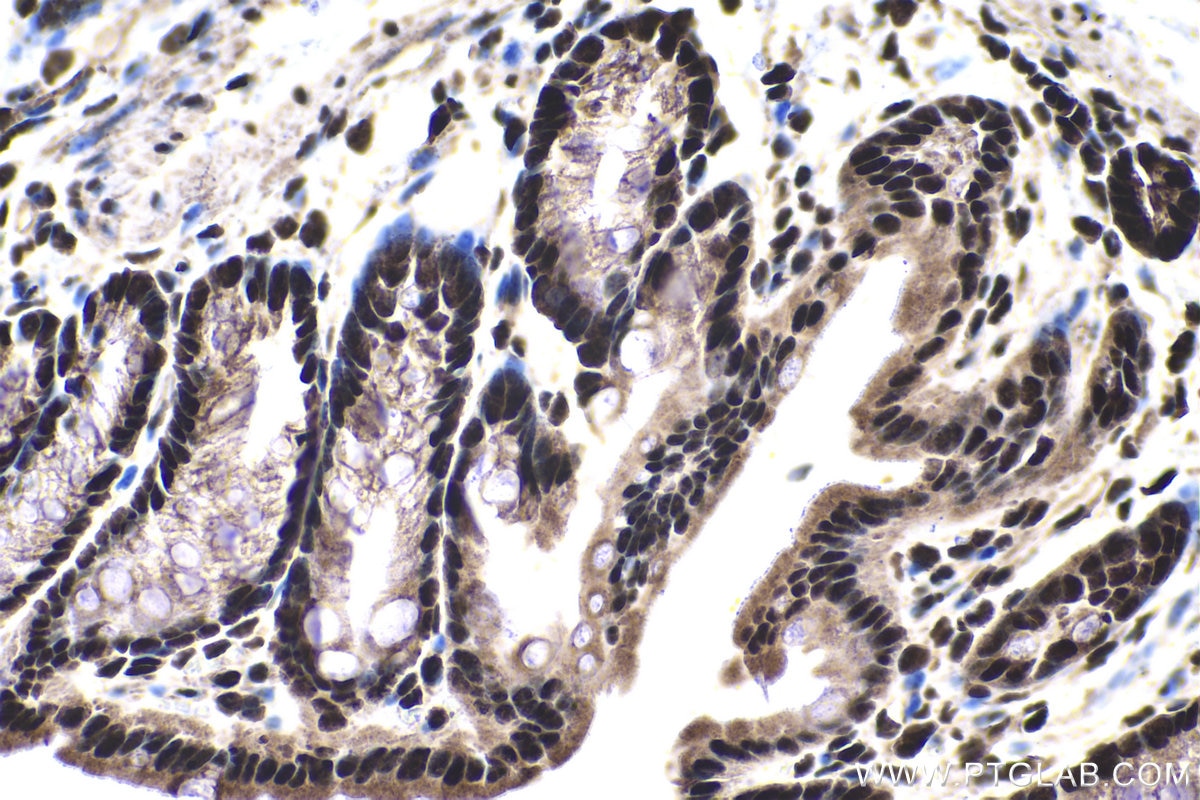 Immunohistochemical analysis of paraffin-embedded mouse colon tissue slide using KHC1390 (SRSF11 IHC Kit).