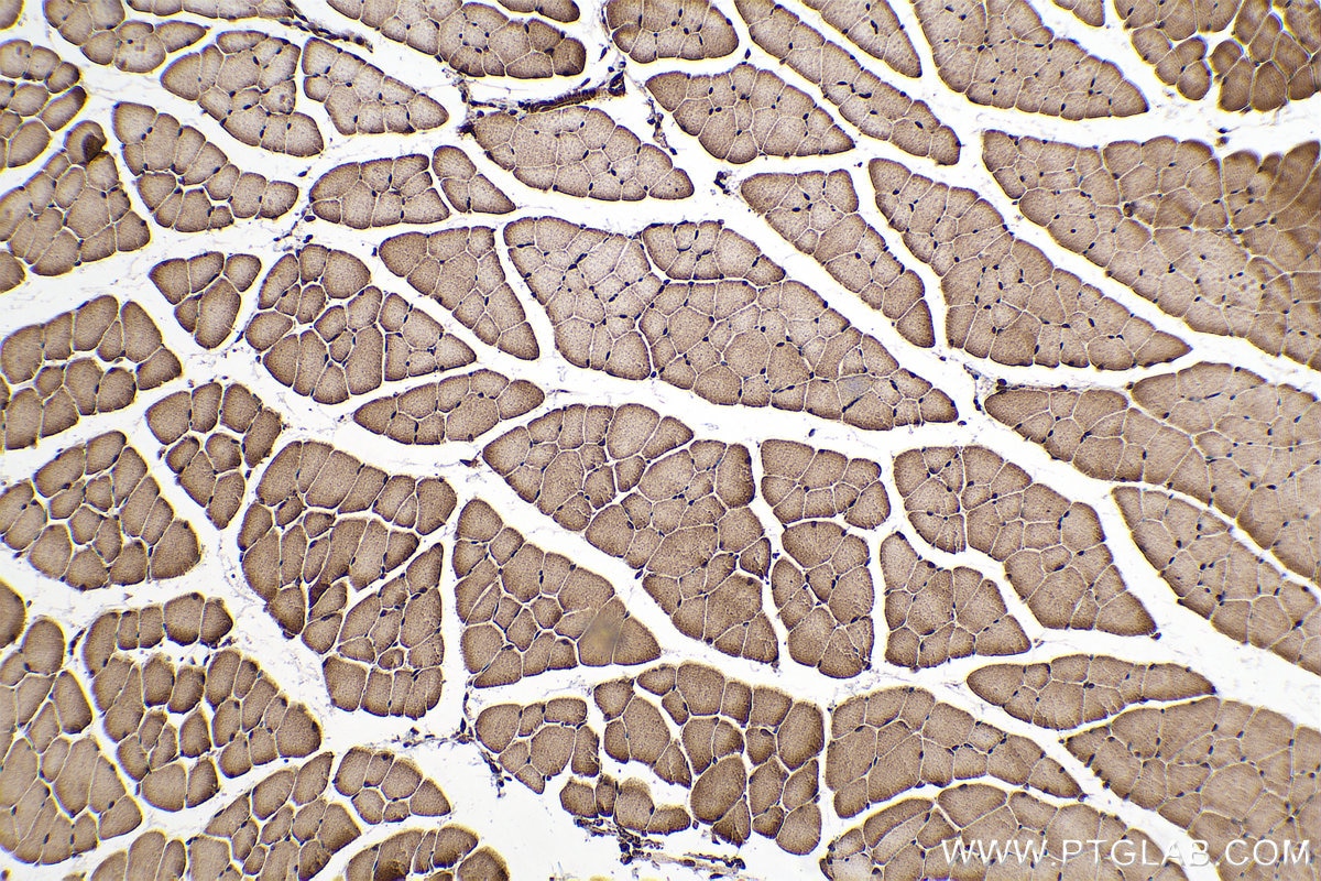 Immunohistochemical analysis of paraffin-embedded mouse skeletal muscle tissue slide using KHC0730 (SRSF3 IHC Kit).