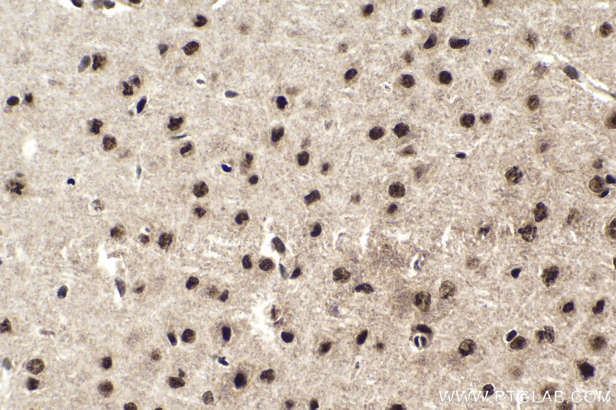 Immunohistochemical analysis of paraffin-embedded mouse brain tissue slide using KHC1708 (SRSF5/SFRS5 IHC Kit).