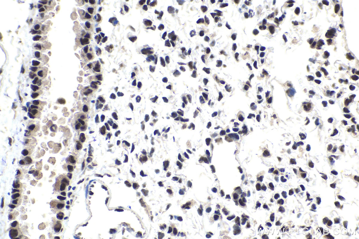 Immunohistochemical analysis of paraffin-embedded mouse lung tissue slide using KHC1762 (SRSF7/SFRS7 IHC Kit).