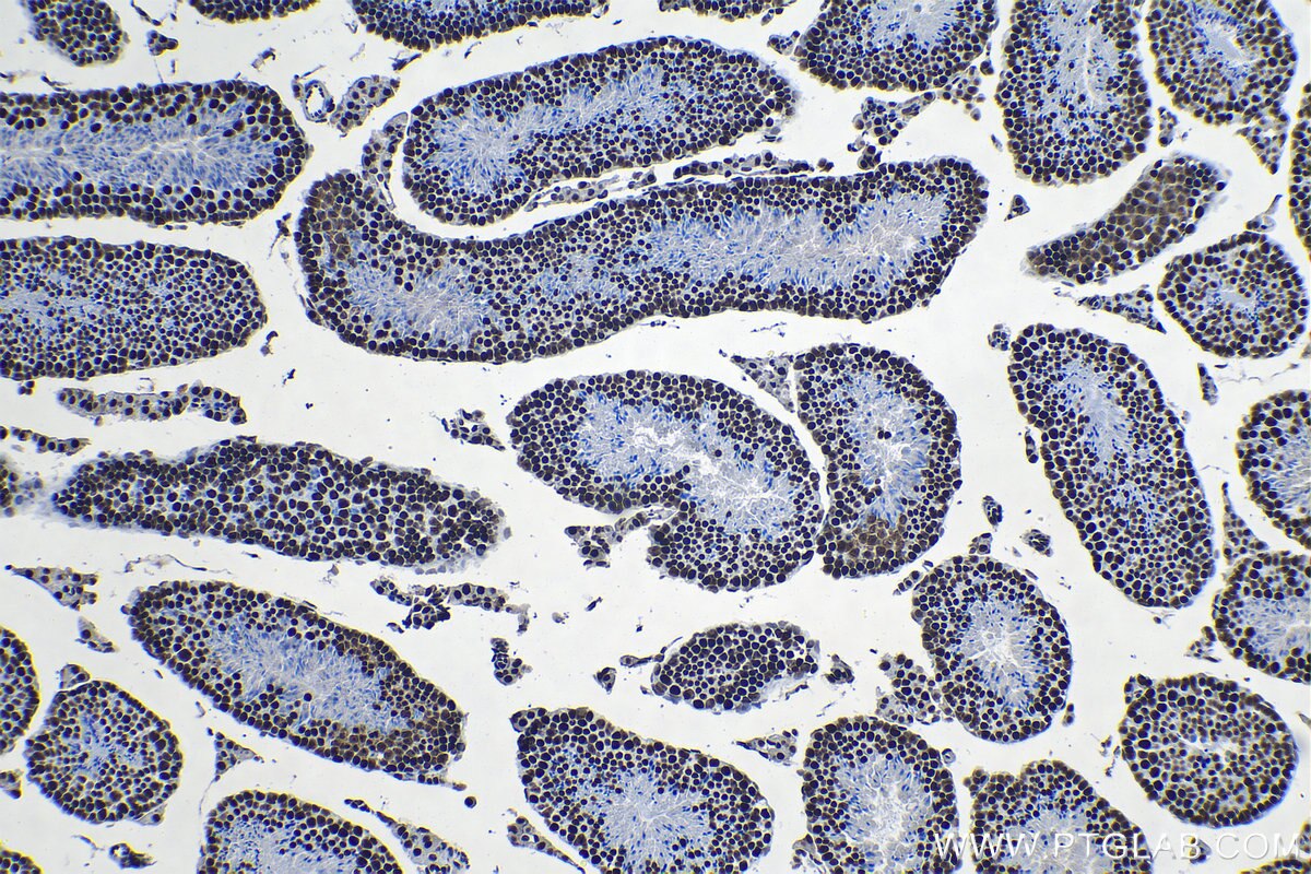 Immunohistochemical analysis of paraffin-embedded mouse testis tissue slide using KHC1319 (SSRP1 IHC Kit).