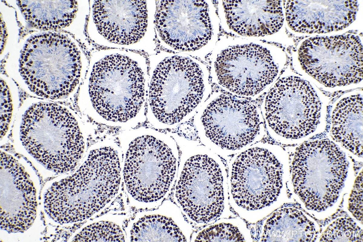 Immunohistochemical analysis of paraffin-embedded rat testis tissue slide using KHC1319 (SSRP1 IHC Kit).