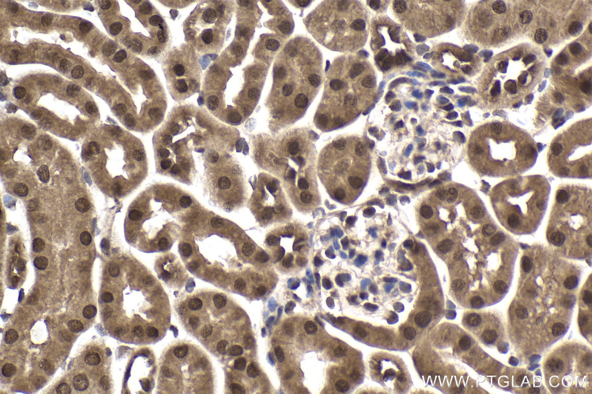 Immunohistochemical analysis of paraffin-embedded mouse kidney tissue slide using KHC1952 (SSU72 IHC Kit).