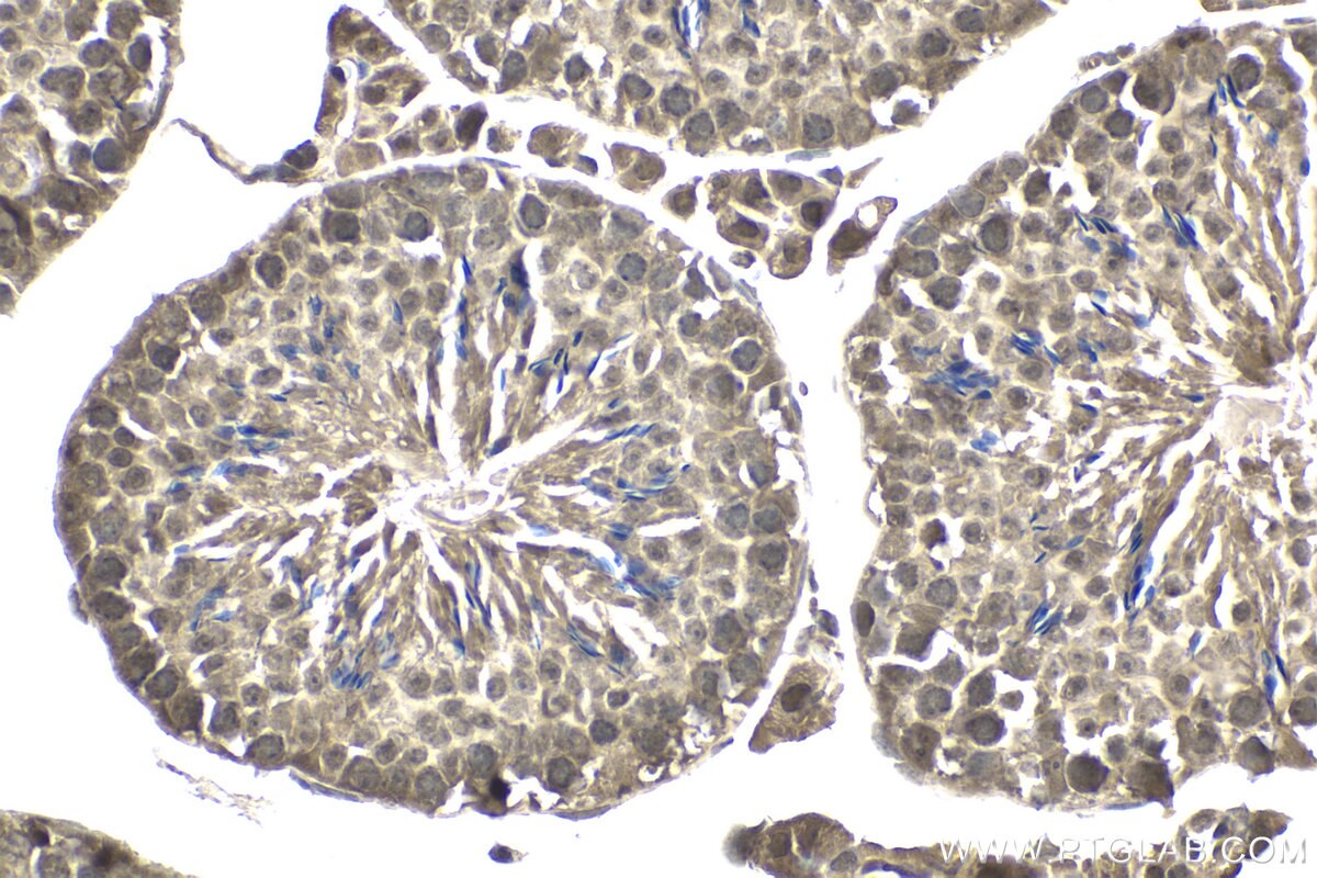 Immunohistochemical analysis of paraffin-embedded mouse testis tissue slide using KHC1952 (SSU72 IHC Kit).