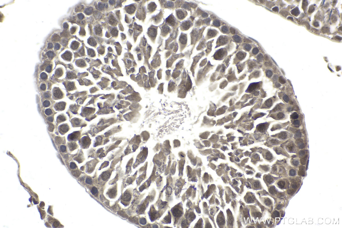 Immunohistochemical analysis of paraffin-embedded rat testis tissue slide using KHC1952 (SSU72 IHC Kit).