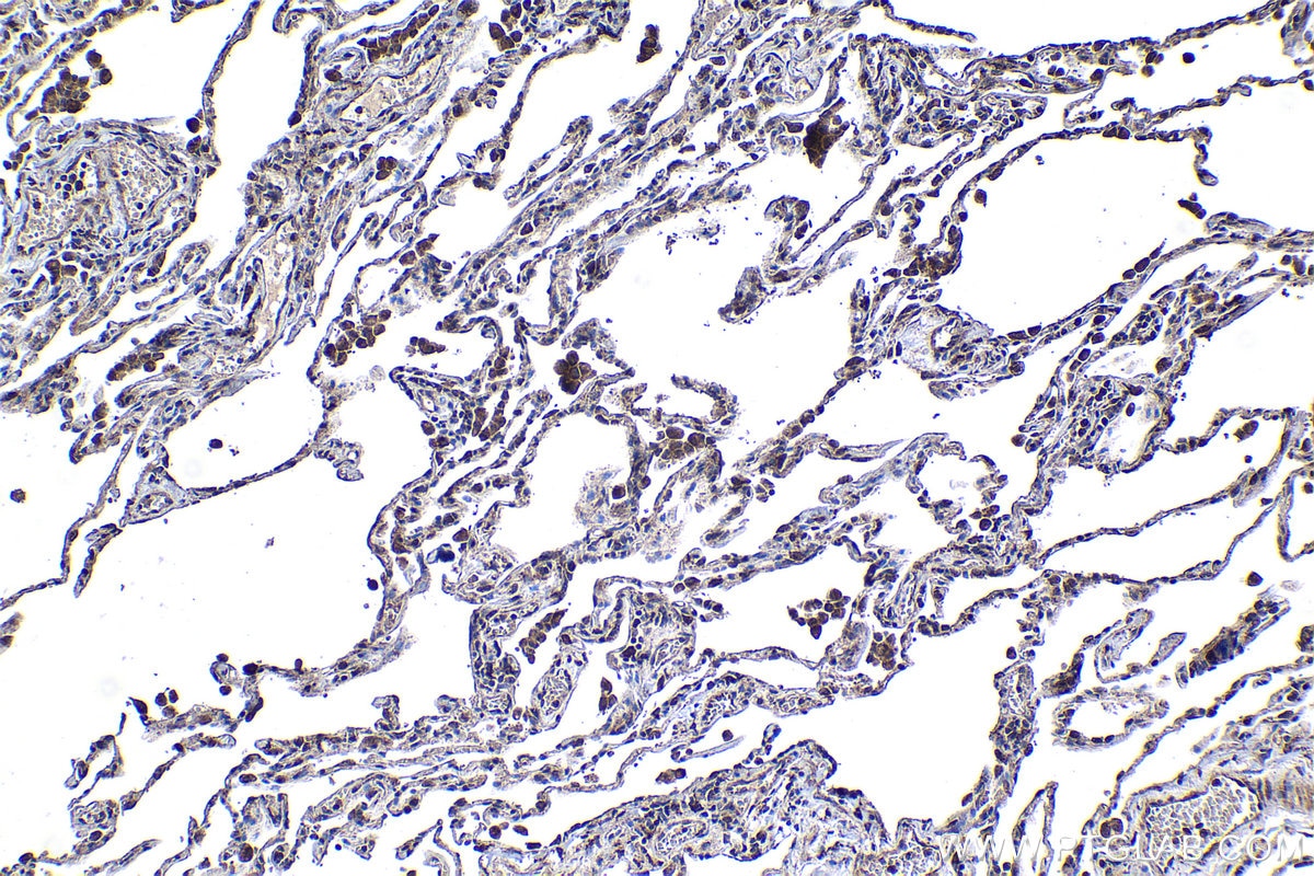 Immunohistochemical analysis of paraffin-embedded human lung tissue slide using KHC1150 (STAB1 IHC Kit).