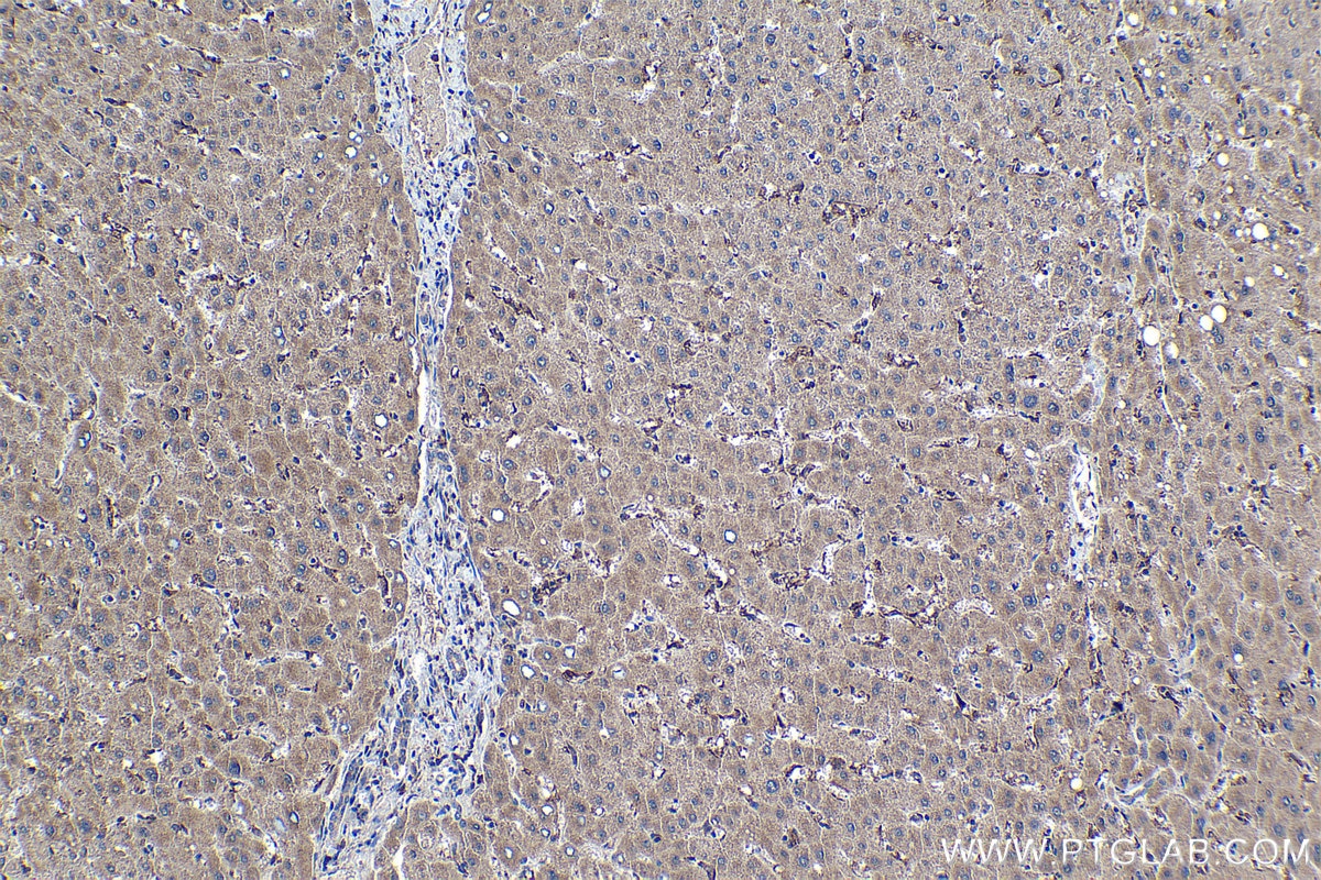 Immunohistochemical analysis of paraffin-embedded human liver tissue slide using KHC1150 (STAB1 IHC Kit).